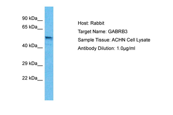 GABRB3 Rabbit Polyclonal Antibody