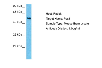 PBX1 Rabbit Polyclonal Antibody