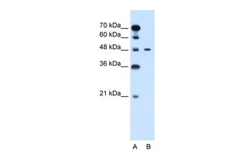 PBX1 Rabbit Polyclonal Antibody