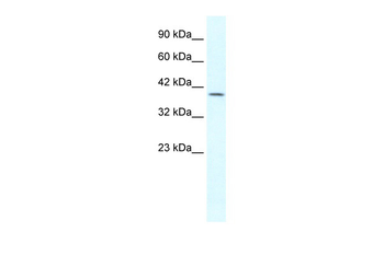 GBX2 Rabbit Polyclonal Antibody