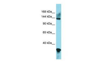 GLI2 Rabbit Polyclonal Antibody