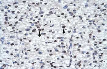 GLI2 Rabbit Polyclonal Antibody