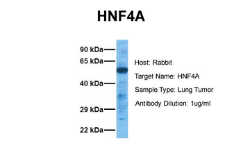 HNF4A Rabbit Polyclonal Antibody