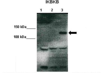 IKBKB Rabbit Polyclonal Antibody