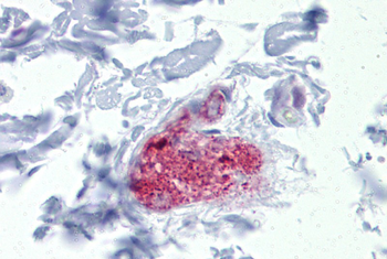 NOTCH4 Rabbit Polyclonal Antibody