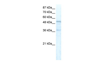 FOXC1 Rabbit Polyclonal Antibody