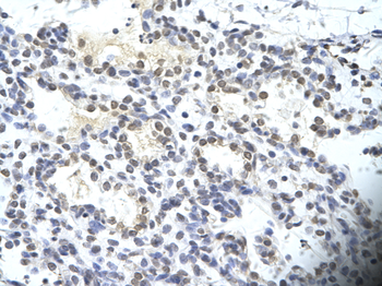 SIRT3 Rabbit Polyclonal Antibody