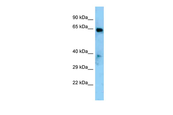 Eya1 Rabbit Polyclonal Antibody