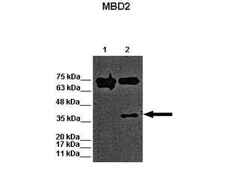 MBD2 Rabbit Polyclonal Antibody
