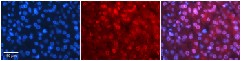 MBD2 Rabbit Polyclonal Antibody