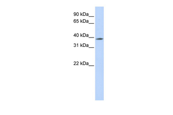MBD2 Rabbit Polyclonal Antibody