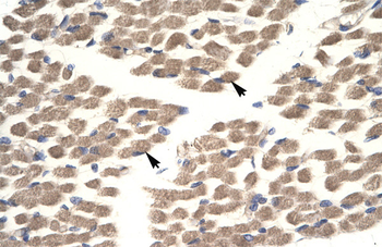 POU2F3 Rabbit Polyclonal Antibody