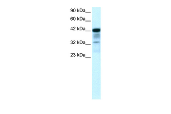 POU2F3 Rabbit Polyclonal Antibody