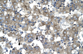 KLF15 Rabbit Polyclonal Antibody