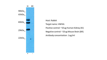 HNF4A Rabbit Polyclonal Antibody