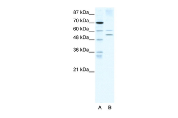 AIRE Rabbit Polyclonal Antibody
