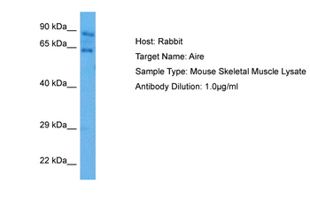AIRE Rabbit Polyclonal Antibody