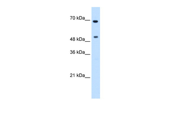 MYC Rabbit Polyclonal Antibody