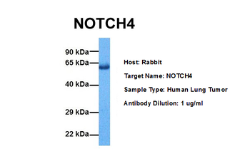 NOTCH4 Rabbit Polyclonal Antibody