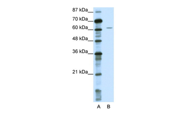 NOTCH4 Rabbit Polyclonal Antibody