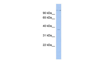 PAX4 Rabbit Polyclonal Antibody
