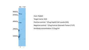 SCD Rabbit Polyclonal Antibody