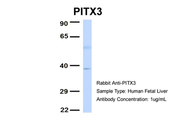 PITX3 Rabbit Polyclonal Antibody