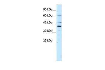 POU4F3 Rabbit Polyclonal Antibody