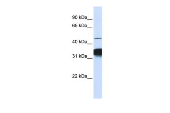 RXRA Rabbit Polyclonal Antibody
