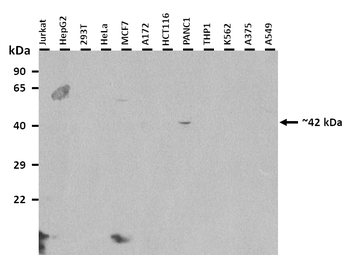 SOX5 Rabbit Polyclonal Antibody