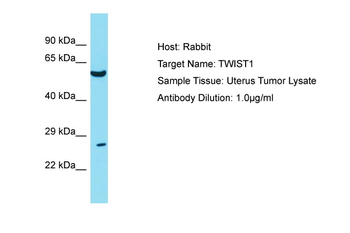 TWIST1 Rabbit Polyclonal Antibody