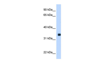 MLX Rabbit Polyclonal Antibody