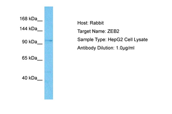 ZEB2 Rabbit Polyclonal Antibody