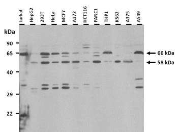 PARP2 Rabbit Polyclonal Antibody