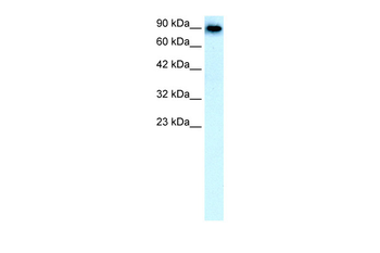 SLC4A1 Rabbit Polyclonal Antibody