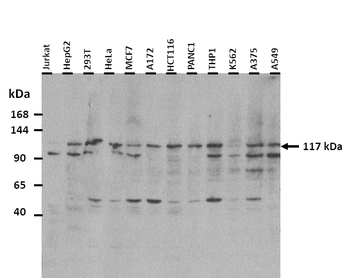 KIF5A Rabbit Polyclonal Antibody