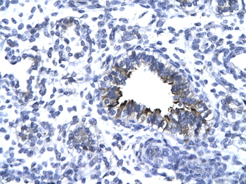 KIF5A Rabbit Polyclonal Antibody