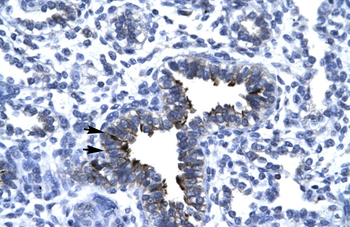 KIF5A Rabbit Polyclonal Antibody