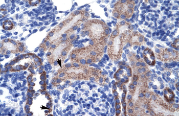 RGS13 Rabbit Polyclonal Antibody
