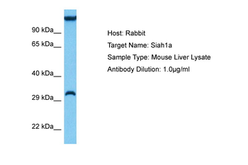 SIAH1 Rabbit Polyclonal Antibody