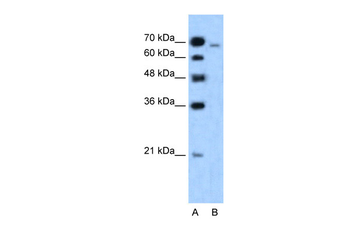 AFDN Rabbit Polyclonal Antibody