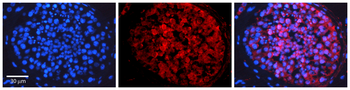 HDAC4 Rabbit Polyclonal Antibody