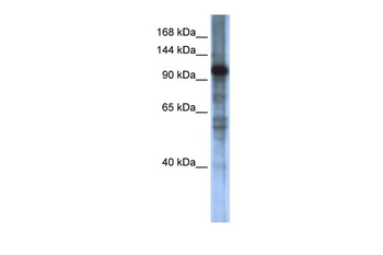 SMARCAL1 Rabbit Polyclonal Antibody