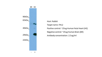 FHL2 Rabbit Polyclonal Antibody