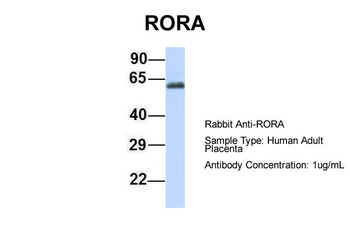 RORA Rabbit Polyclonal Antibody