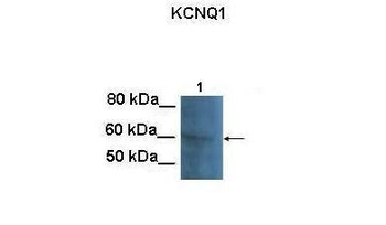 KCNQ1 Rabbit Polyclonal Antibody