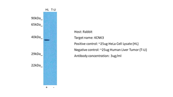 KCNK3 Rabbit Polyclonal Antibody