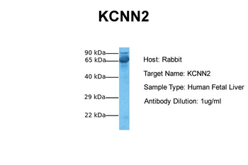 KCNN2 Rabbit Polyclonal Antibody