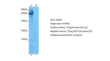 KCNN2 Rabbit Polyclonal Antibody