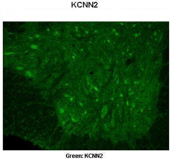 KCNN2 Rabbit Polyclonal Antibody